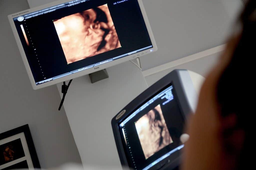 Spätabtreibungen ein schwieriges Thema, Monitor Ultraschall Ärztliche Beratung Diagnose