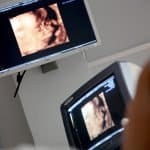 Monitor Ultraschall Ärztliche Beratung Diagnose