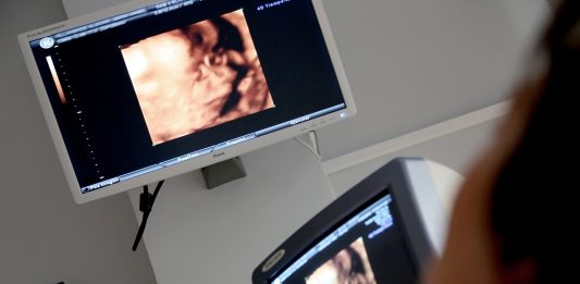 Monitor Ultraschall Ärztliche Beratung Diagnose