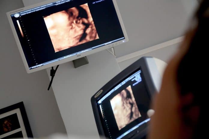 Monitor Ultraschall Ärztliche Beratung Diagnose