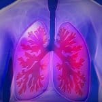 Oberkörper Lunge Copd Krankheit Arzt Befund