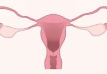 Wieder schwanger nach einer Eileiterschwangerschaft 4. SSW gebärmutter eierstock ovarien gynäkologie