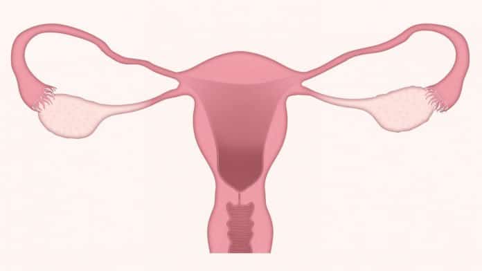 4. SSW gebärmutter eierstock ovarien gynäkologie