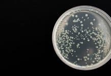 RISIKO UNFRUCHTBARKEIT -CHLAMYDIEN SIND DIE HÄUFIGSTE SEXUELL ÜBERTRAGBARE INFEKTION IN DEUTSCHLAND