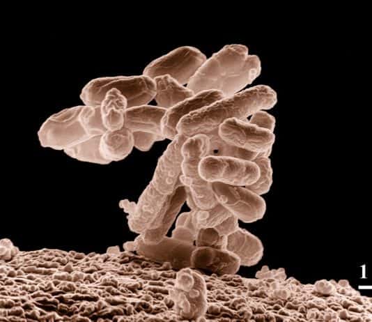 bakterien krankheit escherichia coli