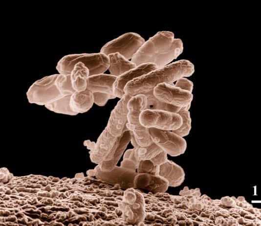 Narkosemittel können das Immunsystem beeinflussen bakterien krankheit escherichia coli