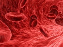 Nabelschnurblut mit Stammzellen: blut, zellen, rot