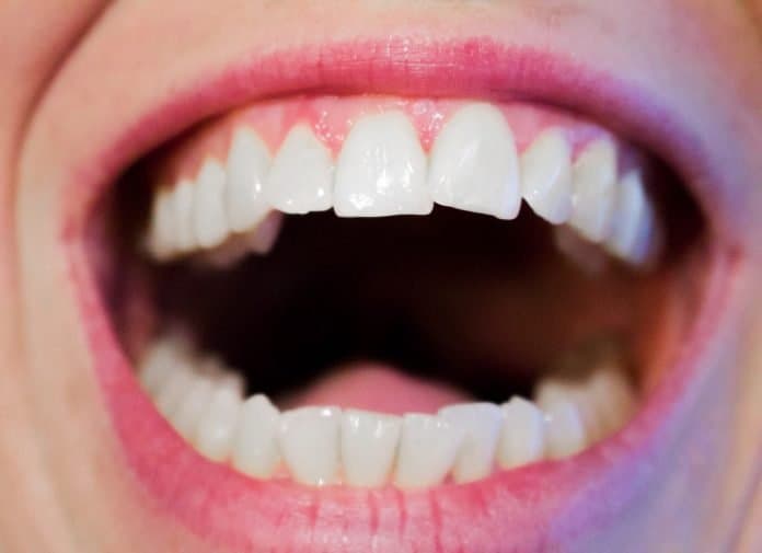 Zähne Zahnarzt Zahnmedizin Mund Weiß Hygiene