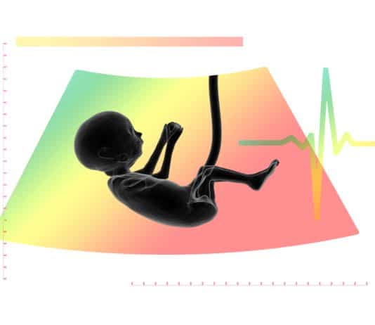 ultraschall, fötus, embryo