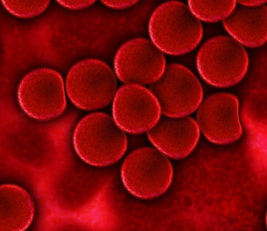 Blutfettwerte – Hohe Fettwerte im Blut können angeboren sein blut blutplasma rote blutkörperchen plasma