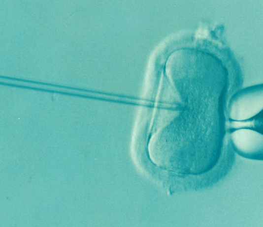 Eine neue Behandlung hilft bei unerfülltem Kinderwunsch ivf fruchtbarkeit unfruchtbarkeit icsi ovum samen