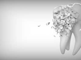 Dein Zahn - erste Hilfe beim Zahnunfall, zahn, zahnheilkunde, das ist lustig
