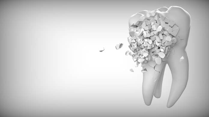 Dein Zahn - erste Hilfe beim Zahnunfall, zahn, zahnheilkunde, das ist lustig