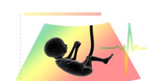 Ultraschall Fötus Embryo Plazenta Logo Nabelschnur