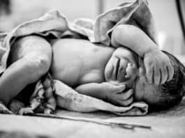 A newborn with a freshly cut umbilical cord lies on a table in the operating room.