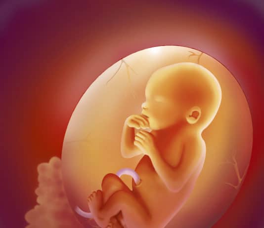 Placing the fetus