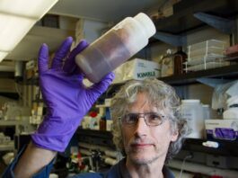 Trotz Vasektomie schwanger: Kannst du immer noch schwanger werden? Photo Positive test