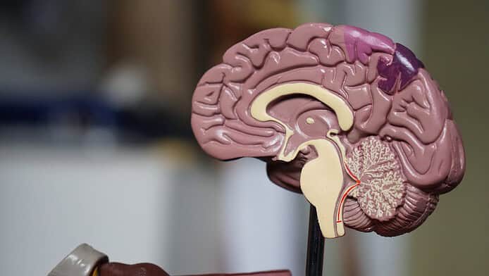 Photo Brain scan