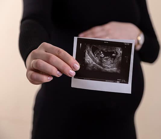 6. ssw. Einfach alles, was Du über die 6. Schwangerschaftswoche wissen musst. Photo Ultrasound scan