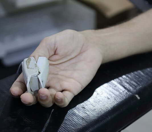 Alles über Vollnarkose bei Kaiserschnitt – Was du wissen musst Photo Operating room