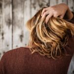 Photo Hair loss