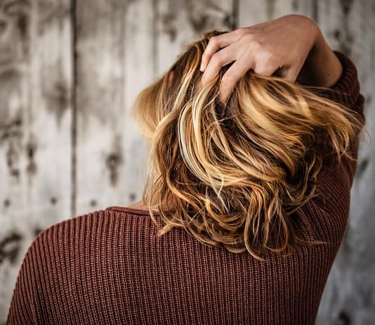 Photo Hair loss