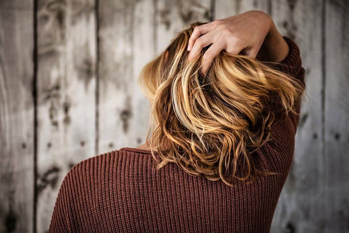Photo Hair loss