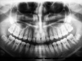ADHS: Wie du die Diagnose erkennen kannst Photo Brain scan