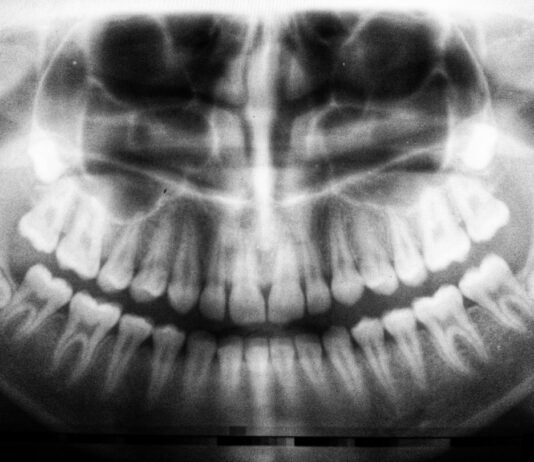 Autismus und ADHS: Wie du sie besser verstehen kannst Photo Brain scan
