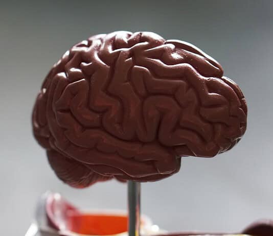 Autismus oder ADHS: Was passt zu dir? Photo Brain scan