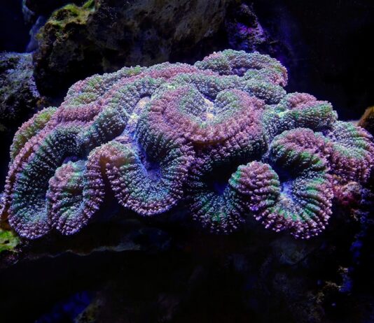 ADHS Ursachen: Was verursacht deine Aufmerksamkeitsdefizit-Hyperaktivitätsstörung? Photo Brain scan