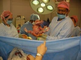 Photo "Breech position cesarean section"